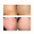 Olio smagliature Revèra